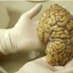 A 2,500 year-old preserved human brain discovered