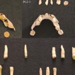 Tooth decay was the major problem for our ancestors 9,000 years ago